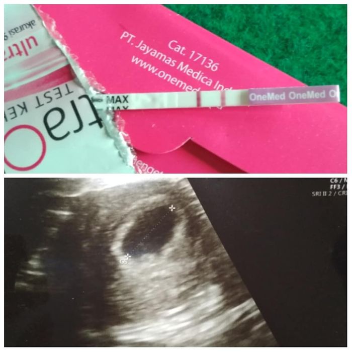 Istri Al. Bani tengah hamil anak kedua