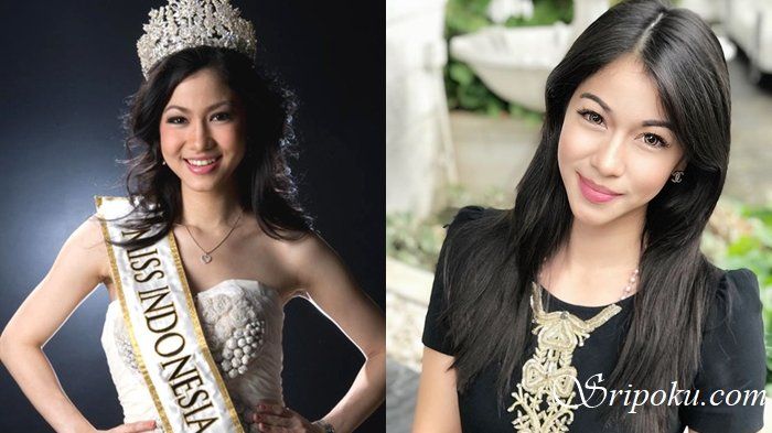 Potret Karenina Sunny, Adik Steve Emmanuel yang Tak Cuma Cantik tapi Juga Kantongi 6 Gelar Ijazah