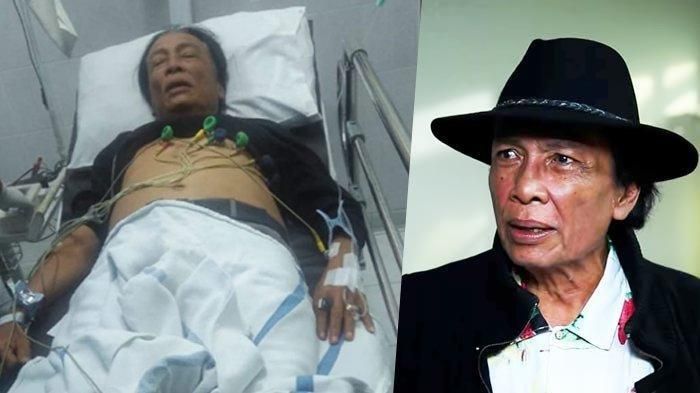 Renggut Nyawa Artis Senior Torro Margens, Makanan Favorit Semua Orang Ini Ternyata Bisa Picu Infeksi