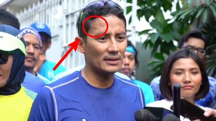 Urat dahi Sandiaga Uno dinilai netizen menyerupai lafaz nama Allah.