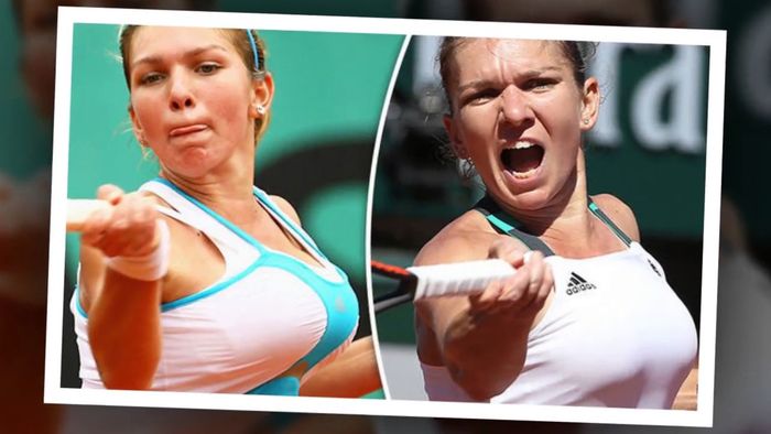 Petenis Simona Halep melakukan operasi pengecilan payudara