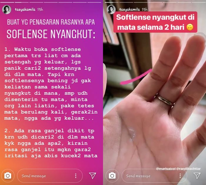 Softlens Nyangkut Di Mata Tasya Kamila Ini 4 Cara Atasi Agar Softlens Bisa Dikeluarkan