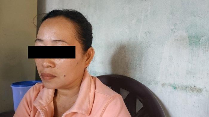 Feni disiram air keras oleh suaminya yang tukang judi di Binjai Utara