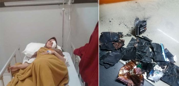 Kondisi Nevi, petugas Diskominfo yang mengalami luka robek pasca hp meledak