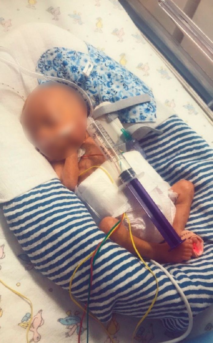 Bayi George yang ukurannya sangat kecil