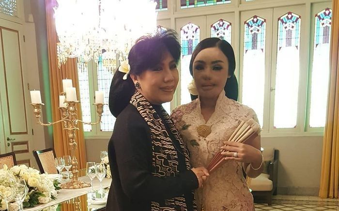Lisa Face off jalani 17 kali operasi wajah