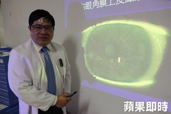 Dokter mata yang merawat Chen