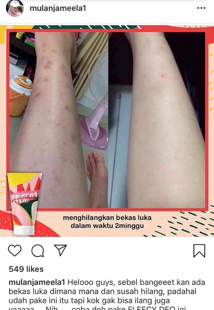 Endorse Mulan Jameela