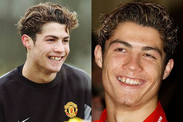 Cristiano Ronaldo semasa muda, sudah terlihat ganteng namun giginya belum rata