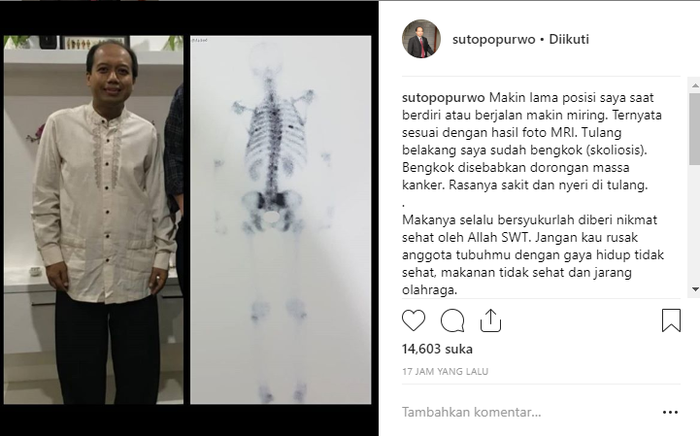 Unggahan Sutopo Purwo Nugroho