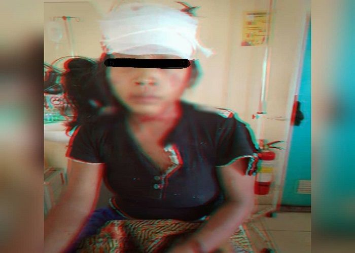 Sang istri ikutan dibacok oleh pelaku setelag menyembelih anak tirinya