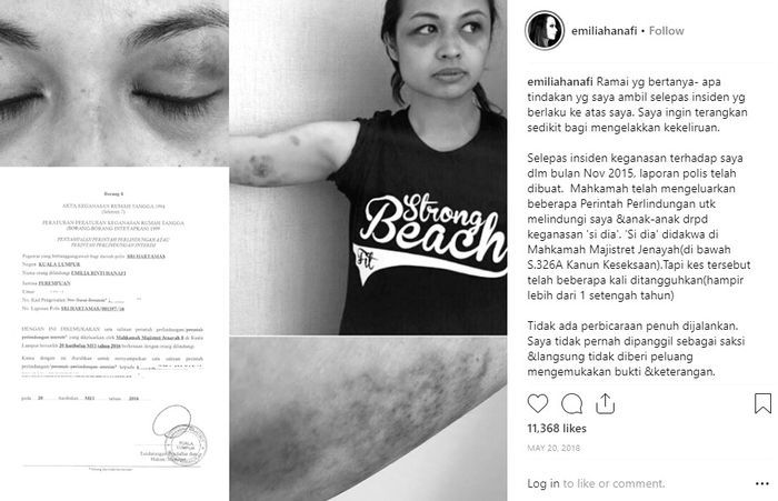 Emilia Hanafi tunjukkan bukti KDRT Faisal Nasimuddin