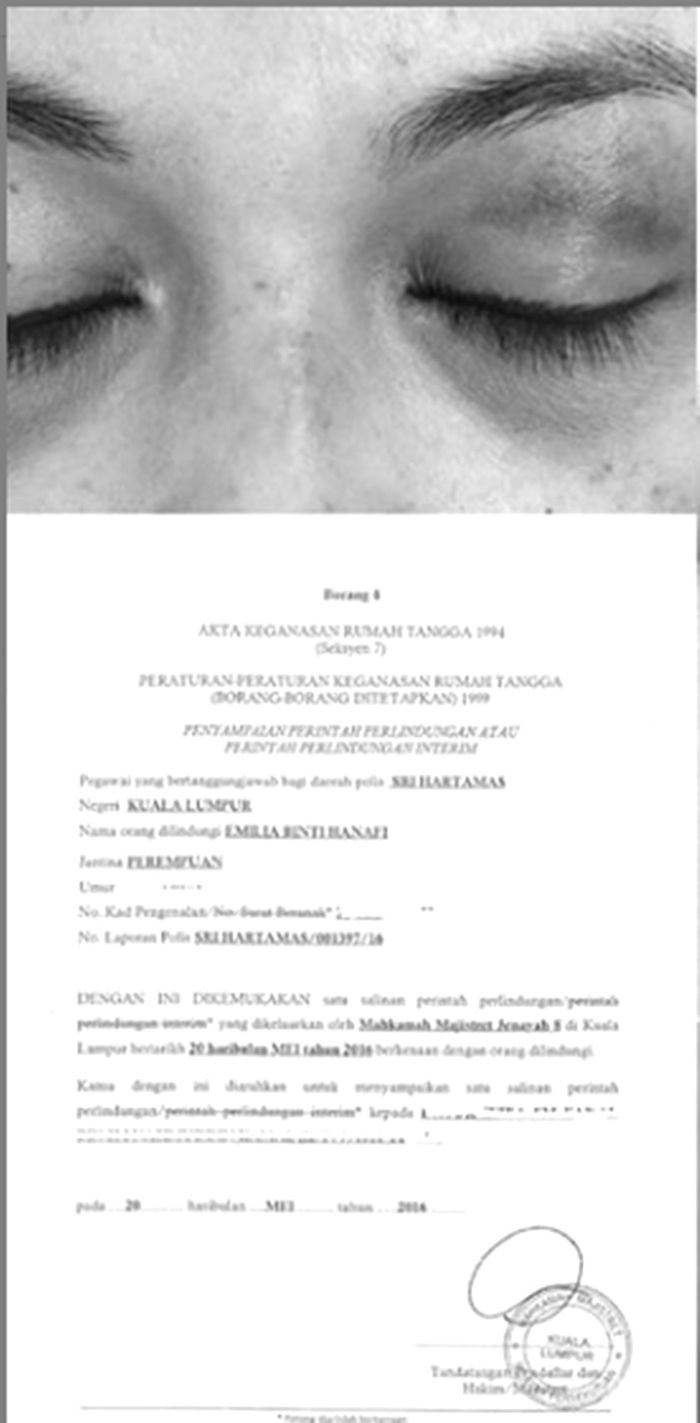 Kasus KDRT Emilia Hanafi