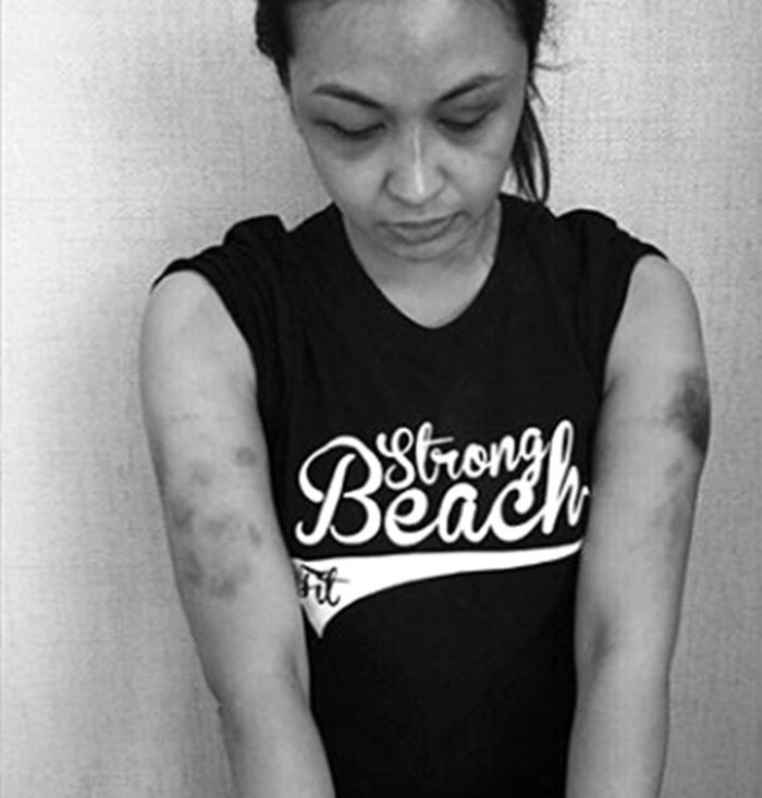 Kasus KDRT Emilia Hanafi
