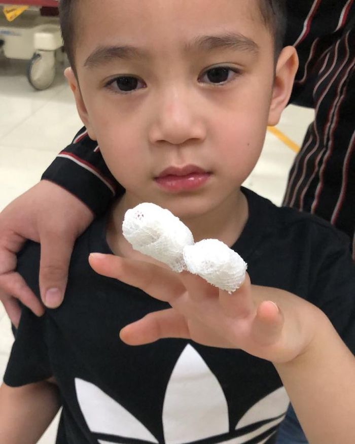 Kuku Tangan Rafathar Lepas Karena Terjepit Pintu Begini Kondisinya Semua Halaman Nakita