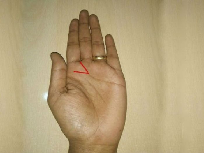 Cek Telapak Tangan Kirimu, Bila Ada Garis Berbentuk 'V' Tandanya Kamu Orang yang Beruntung!