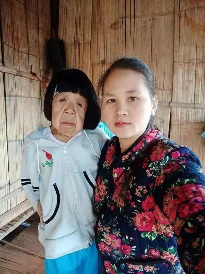 Gadis yang berparas bak nenek-nenek