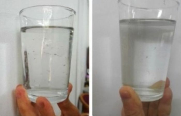 Kotoran dalam kelopak mata yang terangkat