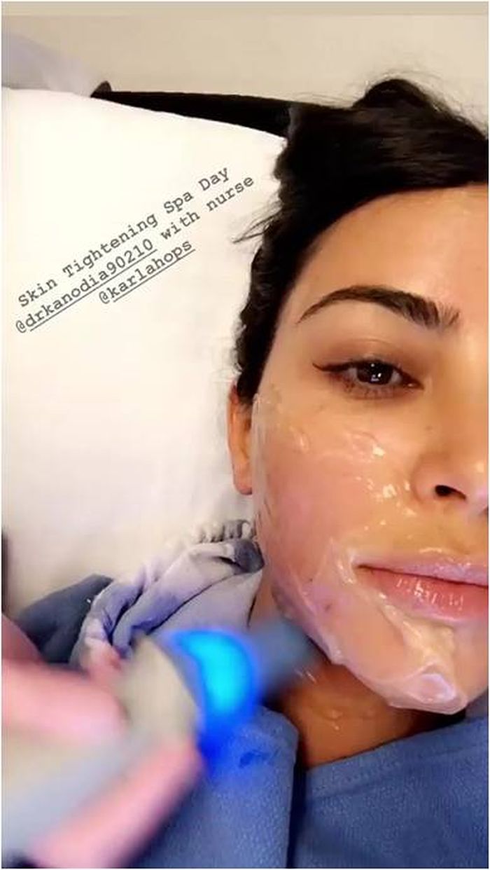 Kim Kardashian lakukan skin tightening demi hilangkan psoriasis