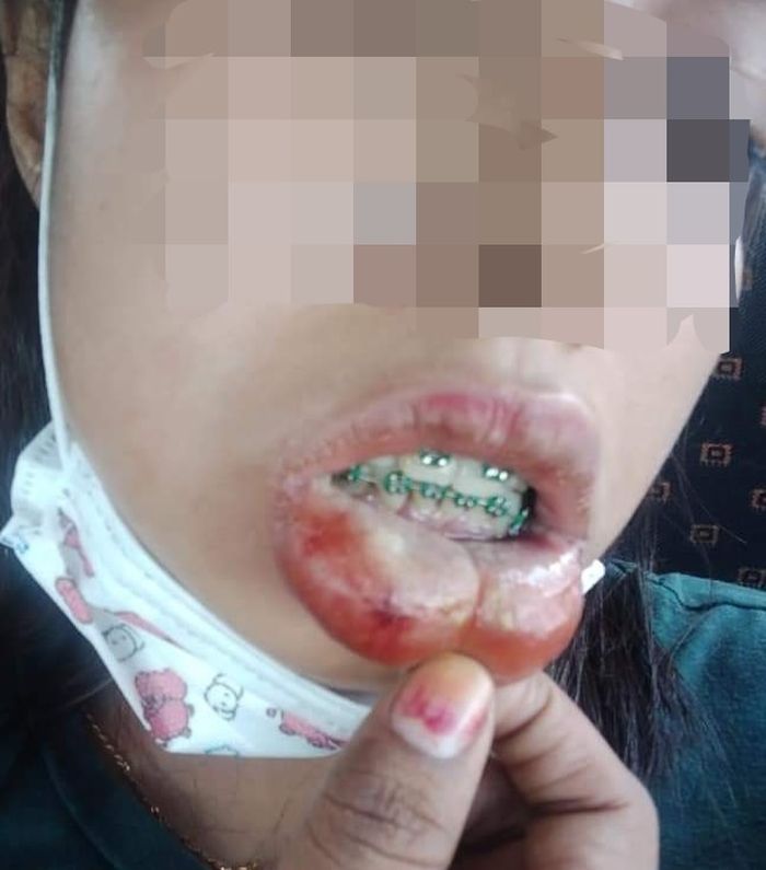 Bibir Jontor