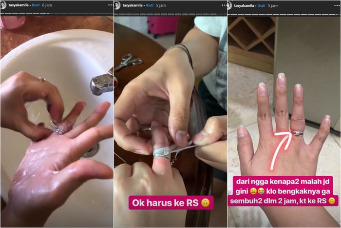 Cincinnya tak lepas dan justru buat jari Tasya bengkak