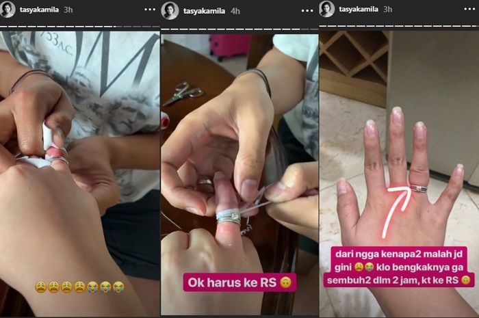 Usaha Tasya Kamila dan Randi Bachtiar saat berusaha melepaskan cincin kawin.