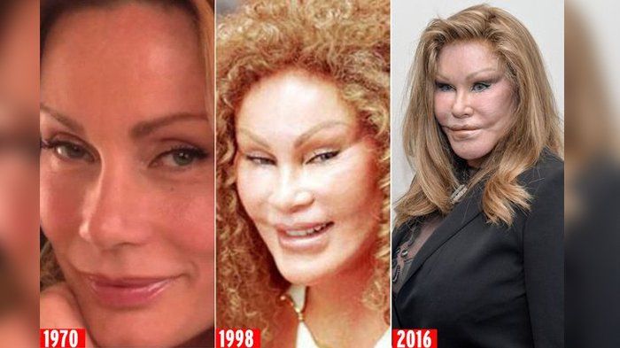 Jocelyn Wildenstein, konglomerat yang tak puas dnegan kecantikan alami malah seperti ini.