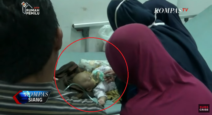 Kondisi bayi yang dikubur hidup-hidup oleh ibu kandungnya sendiri.