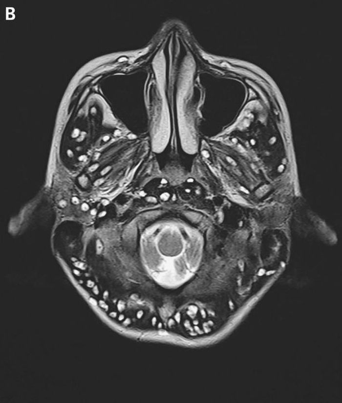Foto kedua scan otak remaja tersbeut.