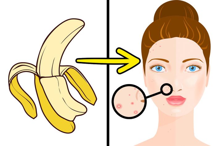 Tak Banyak yang Tahu, Ini Manfaat Kulit Pisang Untuk Kecantikan, Bikin Awet Muda! - Mengurangi Jerawat