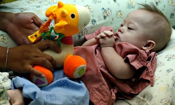 Gammy yang ditinggalkan orangtua aslinya karena menyandang down syndrome