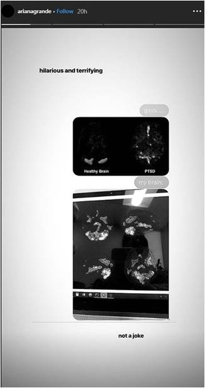 Unggahan scan otak Ariana Grande