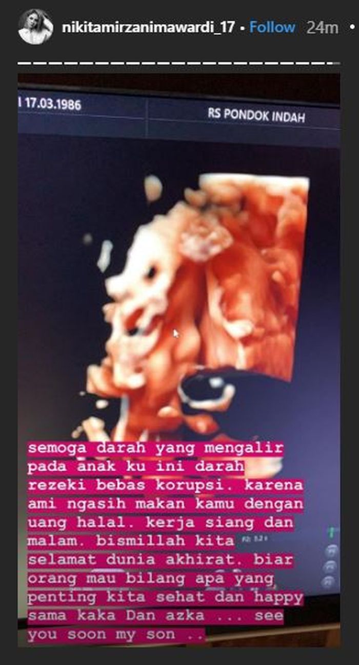 Hasil USG kehamilan Nikita Mirzani.