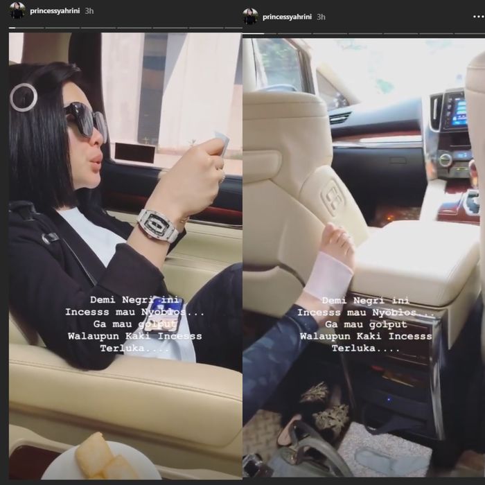 Syahrini cerita kakinya terluka