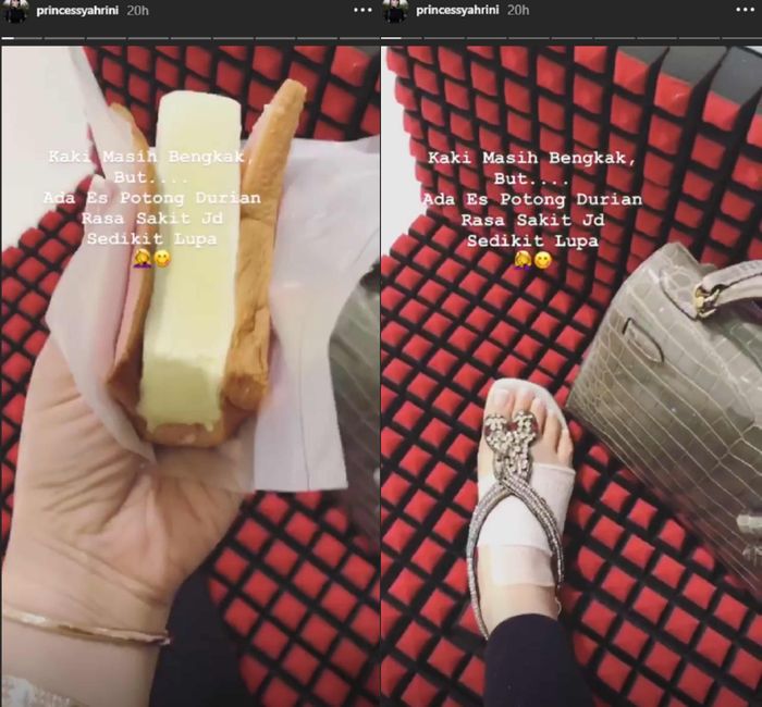 Kabar kaki Syahrini yang tertimpa almari koleksi perfum suaminya