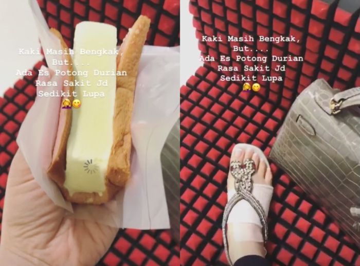 Kaki Syahrini terluka
