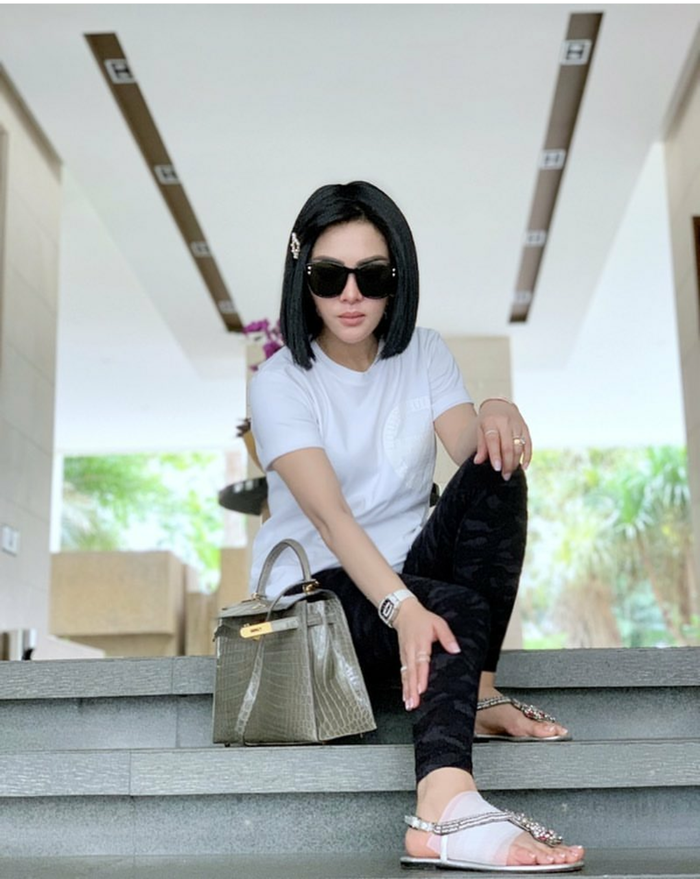 Syahrini tengah berpose duduk sambil memperlihatkan kakinya yang sedang terluka