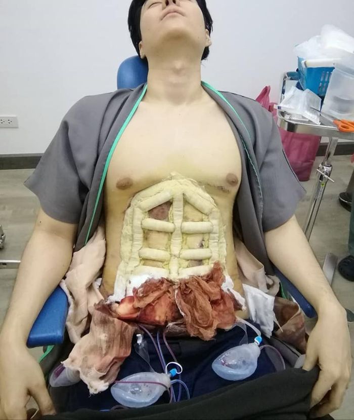 Operasi six pack instan.