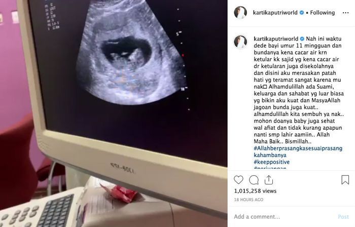 Unggahan Kartika Putri yang menunjukkan perkembangan janinnya