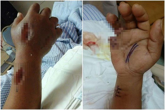 Infeksi bakteri pemakan bakteri