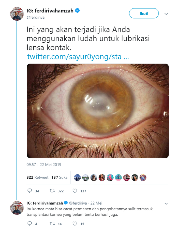 Viral Video Gadis Pakai Softlens Dengan Air Ludah Ini Hal Mengerikan Yang Akan Terjadi Pada Matanya Semua Halaman Nakita
