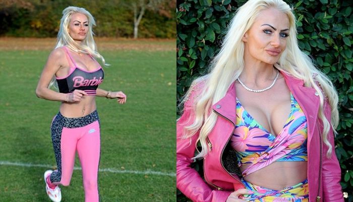 Kerry Miles Usai jalani operasi plastik dan jadi barbie hidup