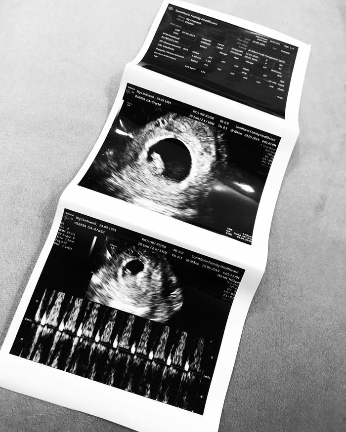 Lindswell Kwok mengandung buah cinta