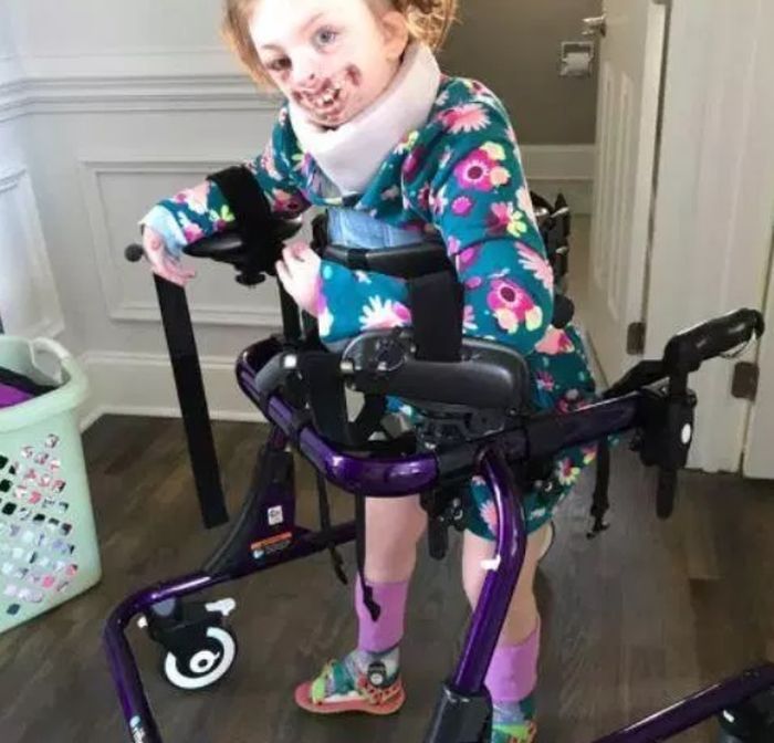 Sophia mengalami kelainan pada wajah, tangan dan kakinya serta diabetes tipe 1 dan sindrom Rett, suatu kondisi yang mempengaruhi kemampuan bicara dan koordinasi.