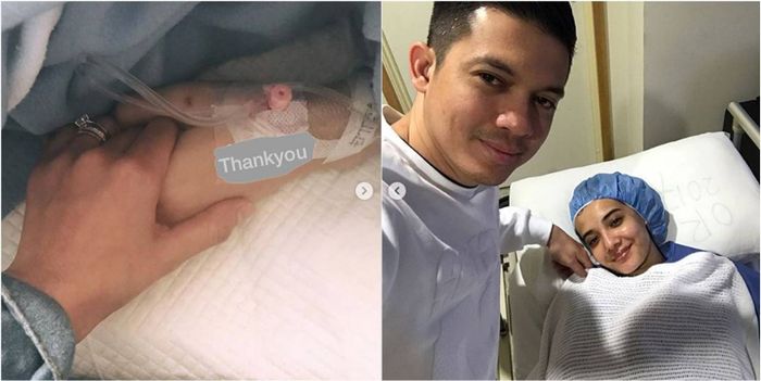 Zaskia Sungkar jalani operasi