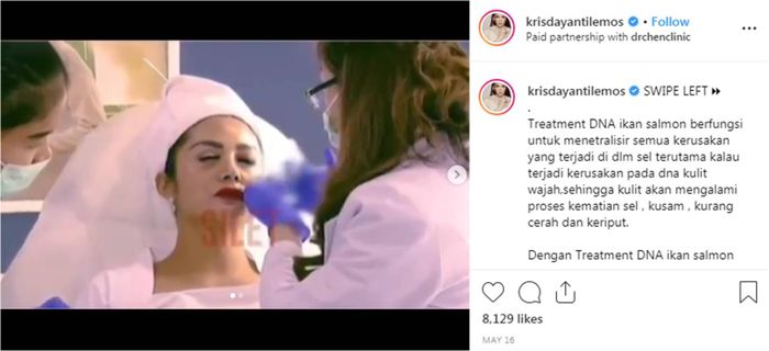 Krisdayanti lakukan suntik DNA ikan salmon.