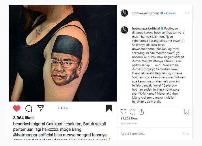 Sindiran Hotman Paris untuk Galih Ginanjar