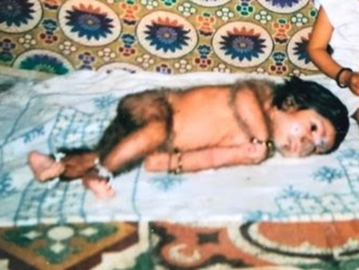 Lalit Patidar saat bayi