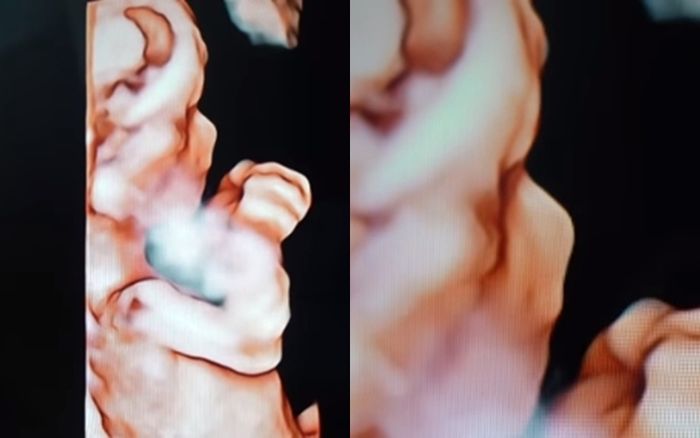 Wajah bayi kembar anak Ammar Zoni dan Irish Bella