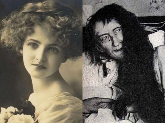 Blanche Monnier, dipenjara ibunya sendiri 25 tahun karena mempertahankan cinta.